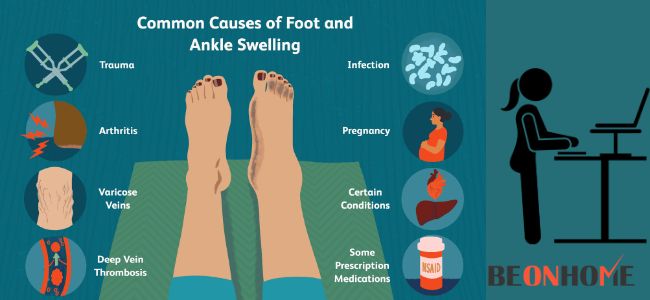 Causes Of foot and ankle Swelling